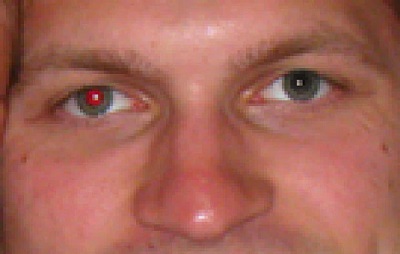 red eye photo