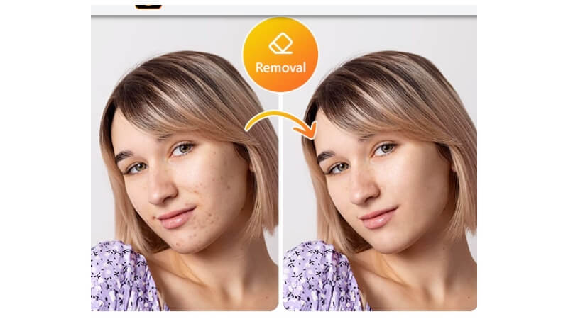 remove blemishes from photos